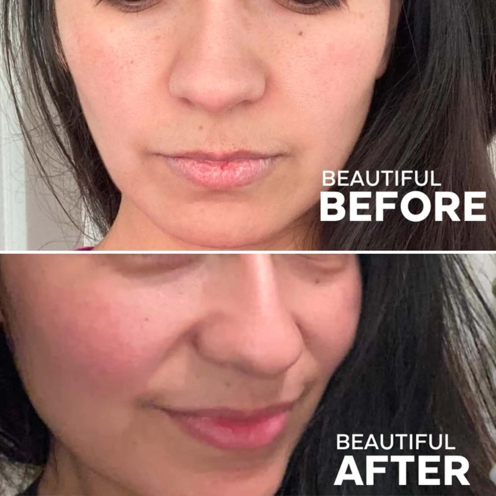 Lip Treatment Kit